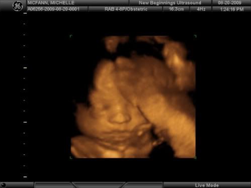 this was Maveric's last Ultrasound pic they look soooo much alike 