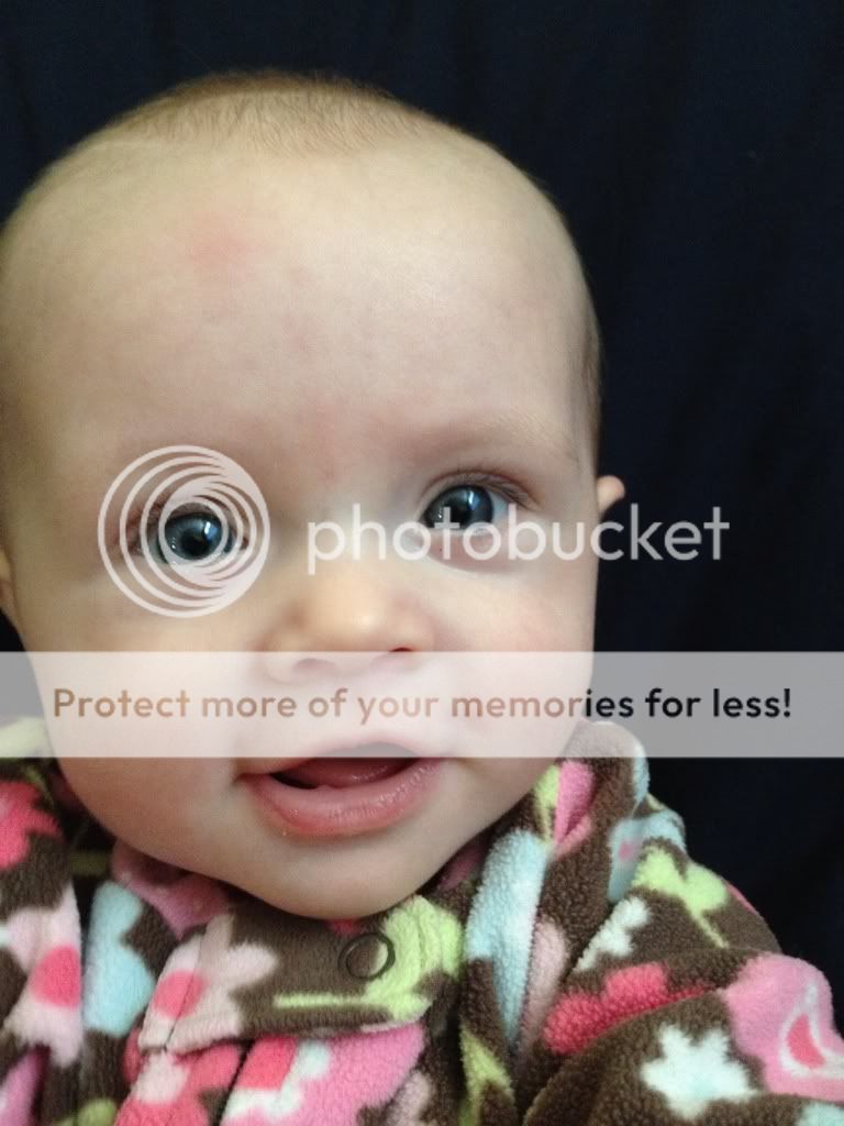 Blister on lip?? BabyCenter